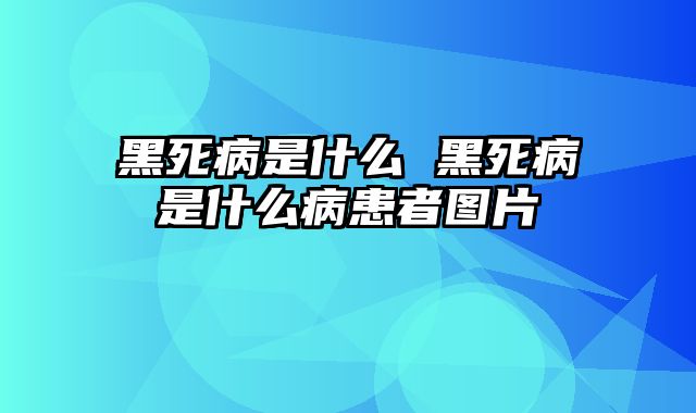 黑死病是什么 黑死病是什么病患者图片